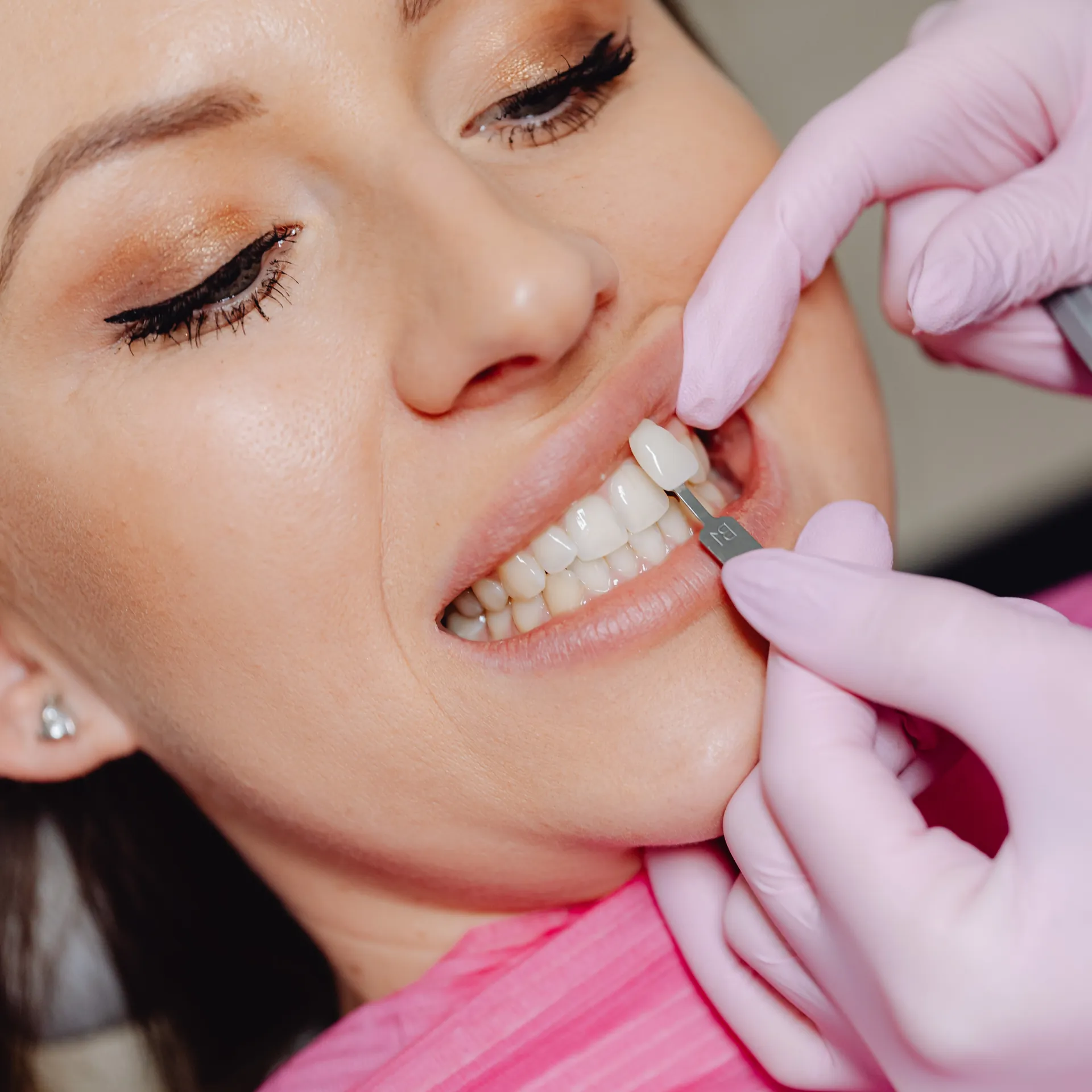 Beautiful Smile at Pacific Smiles Dental